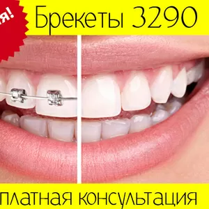 Брекеты Киев 3290 грн. по Акции