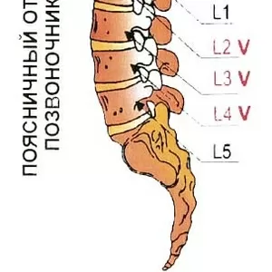 Восстановление позвоночника за Пять дней